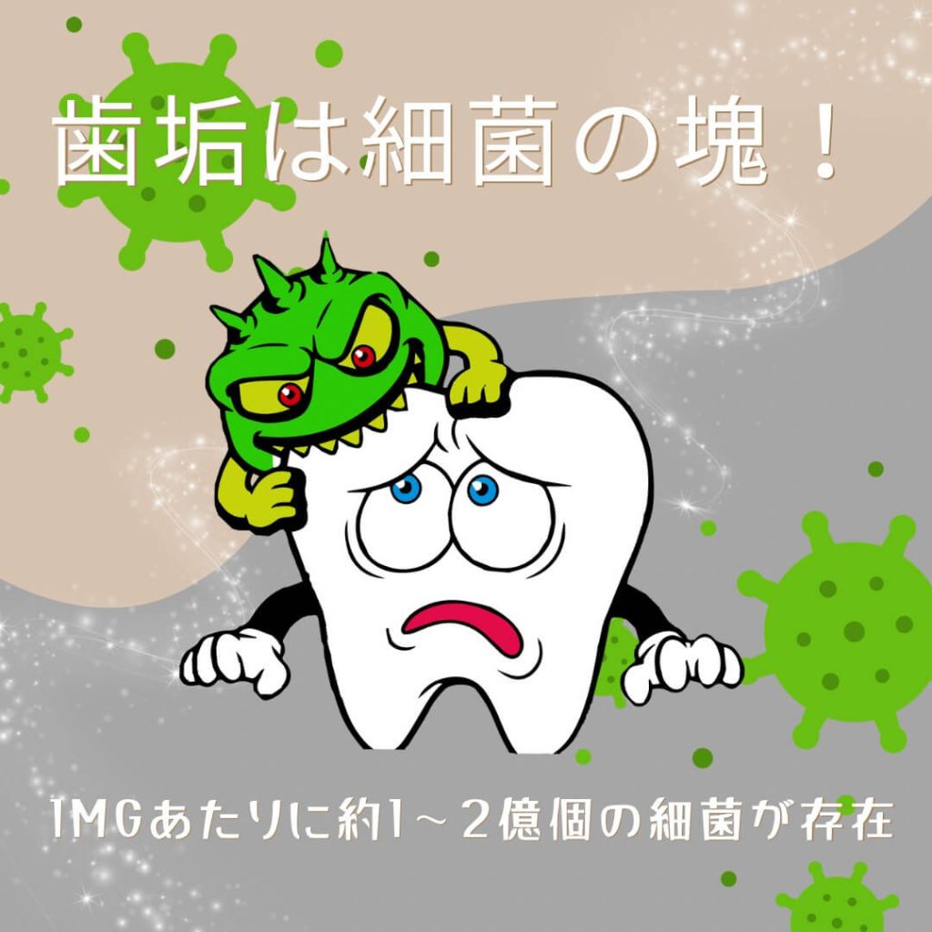 知っているようで知らない歯垢と歯石について