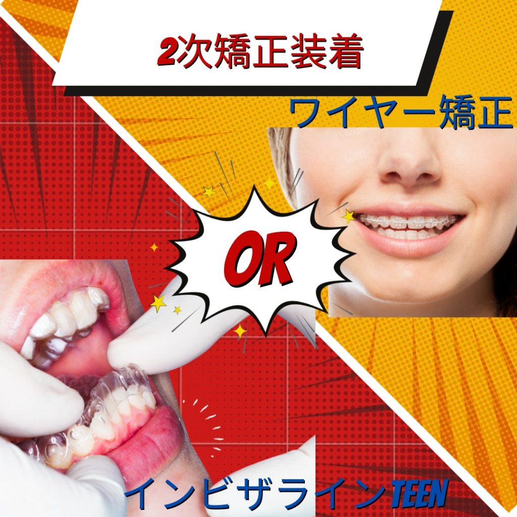子供の矯正治療はいつ頃始めるのが良い？〜 恵比寿、伊勢原のピュアグループ〜
