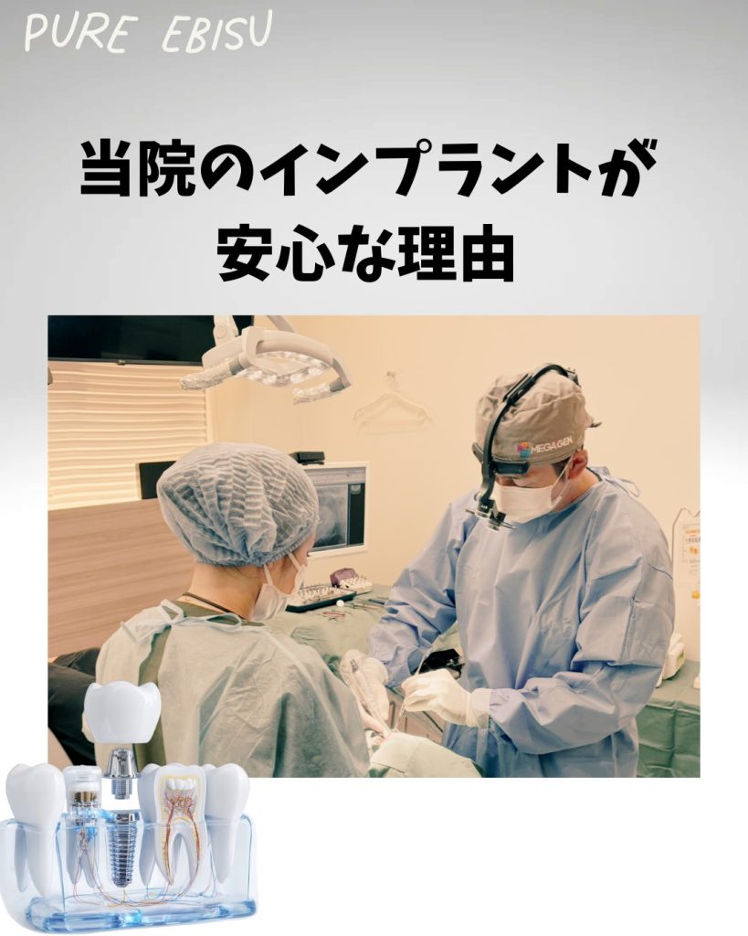 当院のインプラントが安心な理由