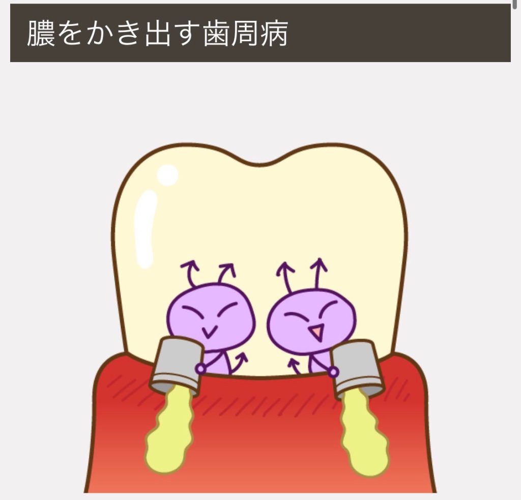 クリーニングの重要性